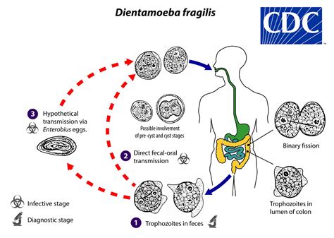  Dientamoeba Fragilis: This Tiny Parasite Can Pack Quite a Punch When It Comes to Causing Gastrointestinal Distress!