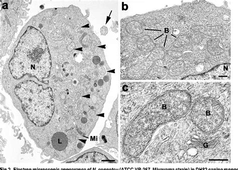  Neorickettsia sennetsu A Tiny Trematode Parasite Causing an Unexpected Fever 