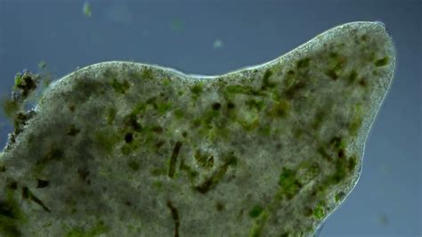  Pelomyxa: A Gigantic Amoeba That Thrives On Bacteria And Leaves Scientists Scratching Their Heads!