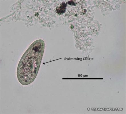  Macrostoma: A Ciliate That Swims Backwards!